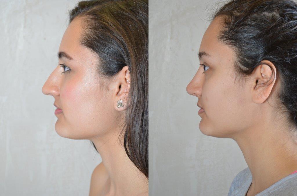 Society Nose Best
